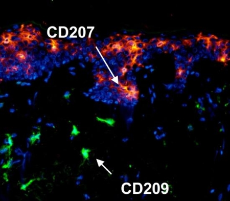 CD207/CD209 immunolabeling
