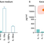 Quantification of the IL-1 family member proteins in keratinocyte culture medium (A) and in keratinocyte extract (B)