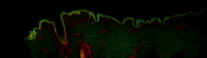 Scanning de lame - Coupe d’explant de peau humaine marquée en fluorescence - image entière