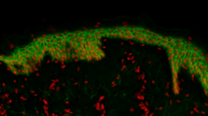 Scanning de lame - Coupe d’explant de peau humaine marquée en fluorescence - image zoomée