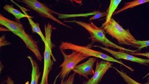 Labeling of normal human dermal fibroblasts (ß-tubulin in green, actin in red, nuclei in blue)