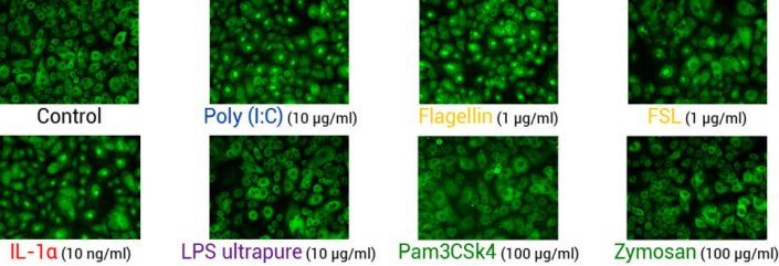 Analysis of NF-kB translocation in keratinocytes stimulated with IL-1α or TLR agonists