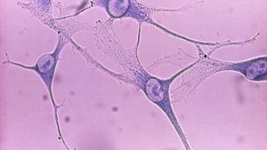 3 Mélanocytes épidermiques humains normaux (Giemsa)