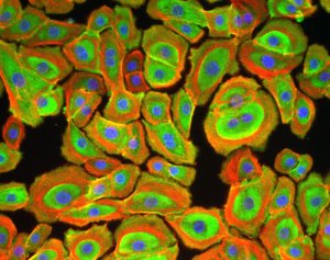 Labeling of NHEK (Myosin in green, actin in red, nuclei in blue)