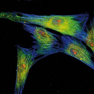 Labeling of normal human dermal fibroblasts (Myosin in green, actin in blue, nuclei in red)