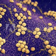 Colony of Staphylococcus aureus bacteria