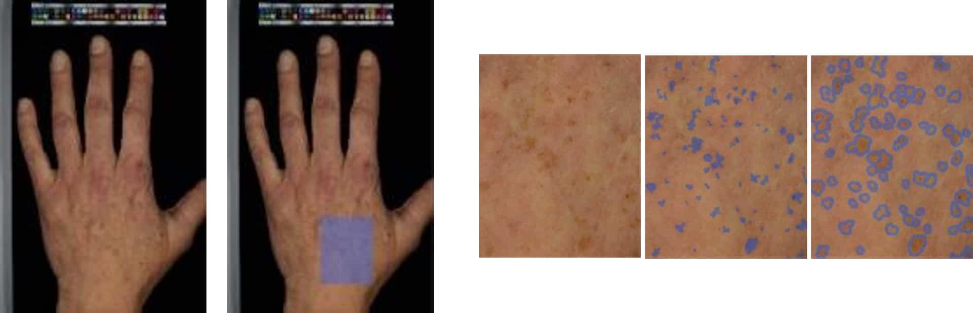 Skin pigmentation - Cosmetic efficacy studies, in vitro tests
