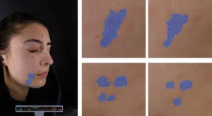 Analyse de PIH en visage entier sur images acquises au ColorFace ®  