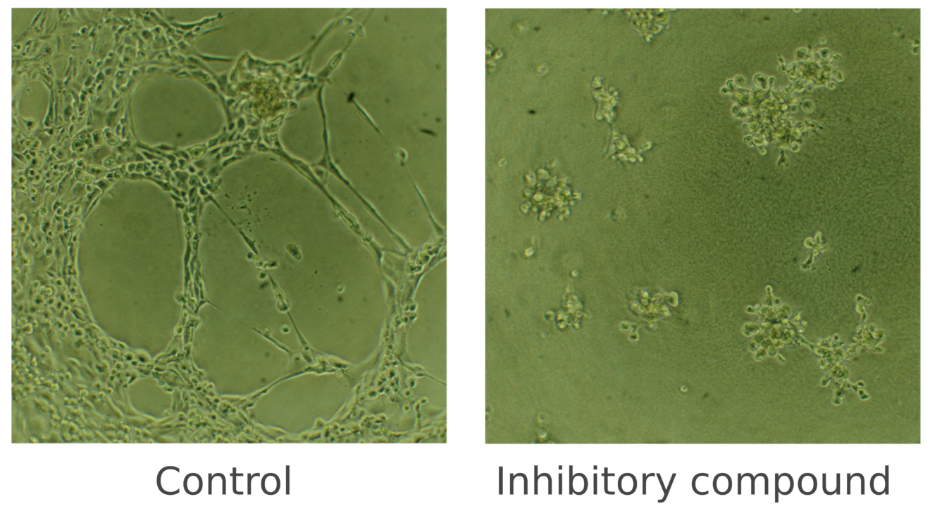 In Vitro Assays to Study The Hallmarks of Cancer | QIMA Life Sciences