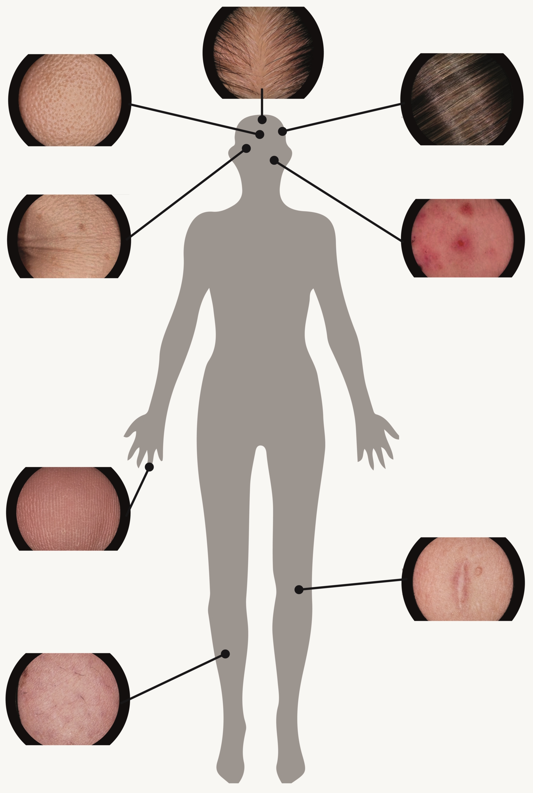 Skincam can image any part of the body.