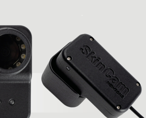 Portable camera Skincam