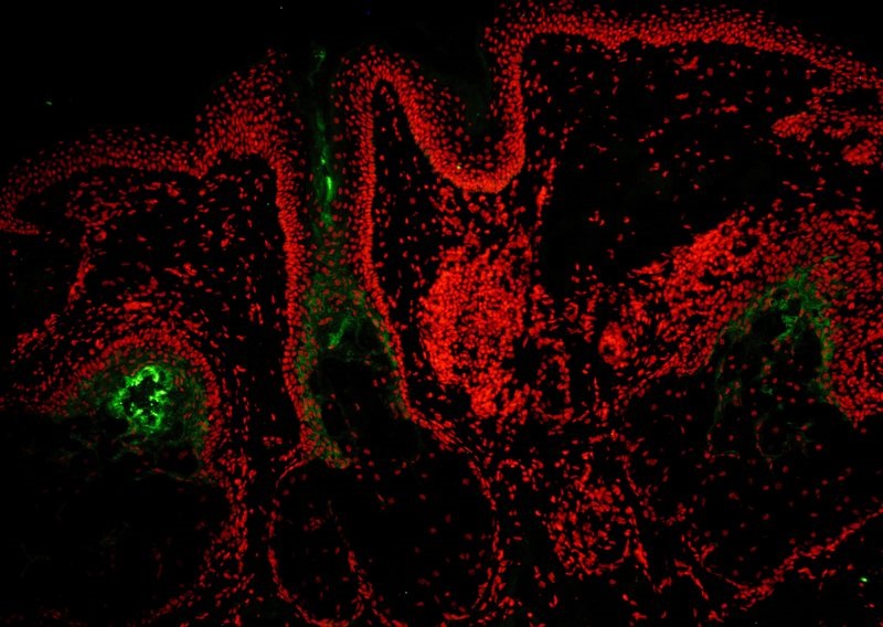 Human hair explant: Models and assays | QIMA Life Sciences