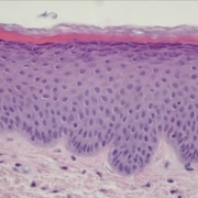 Human skin explant (HE staining)