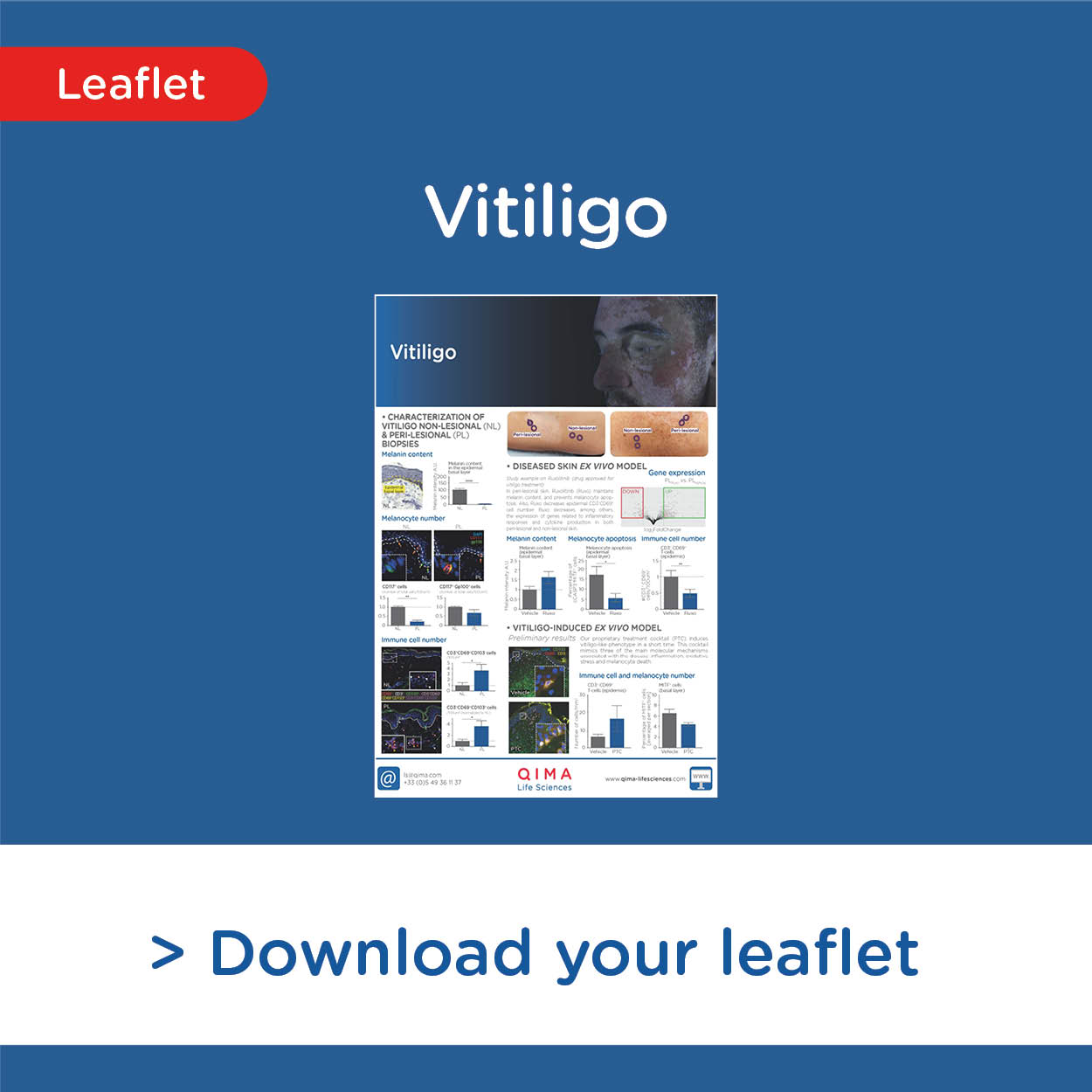 Vitiligo leaflet download invitation