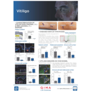 vitiligo flyer thumbnail