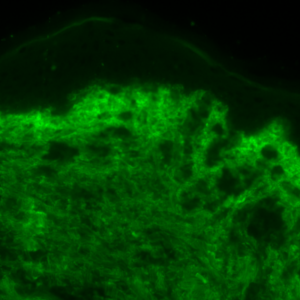 Collagen_Normal