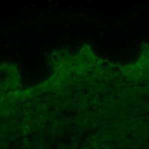 Collagen_Speed aged