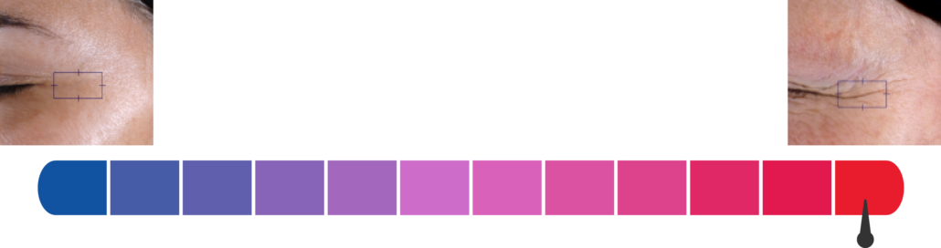 SCAWA Scales illustration