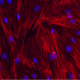 Actin staining in fibrolast senescence model