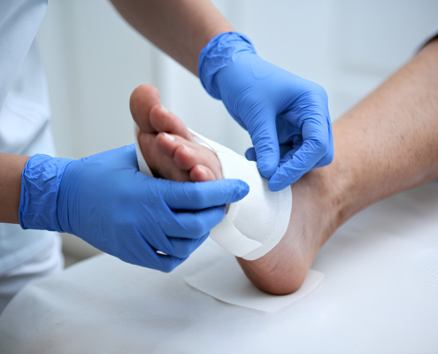 Wound and diabetes