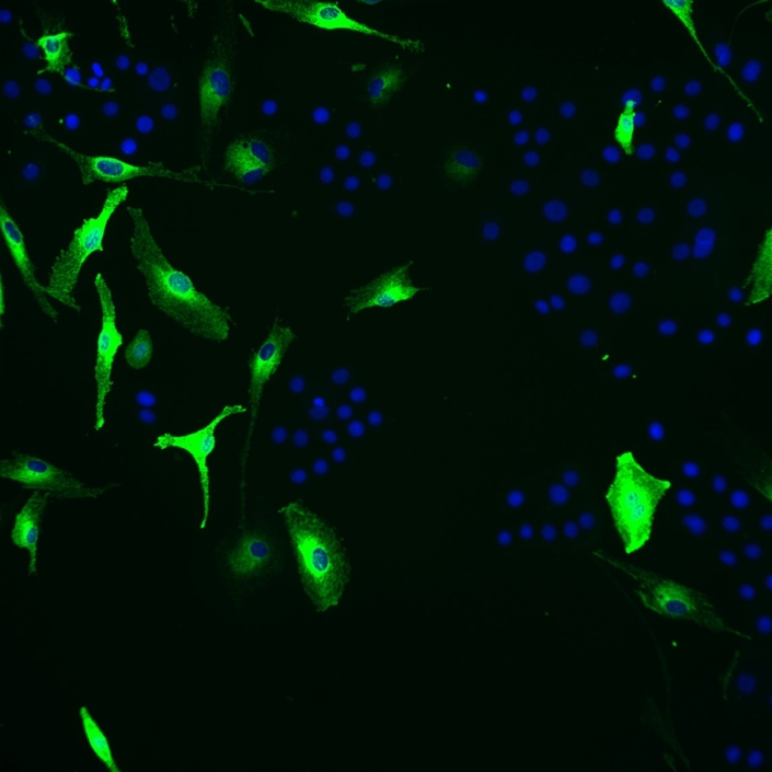Human senescent melanocytes in vitro model | QIMA Life Sciences
