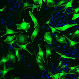 IBMX H2O2 Melanocytes