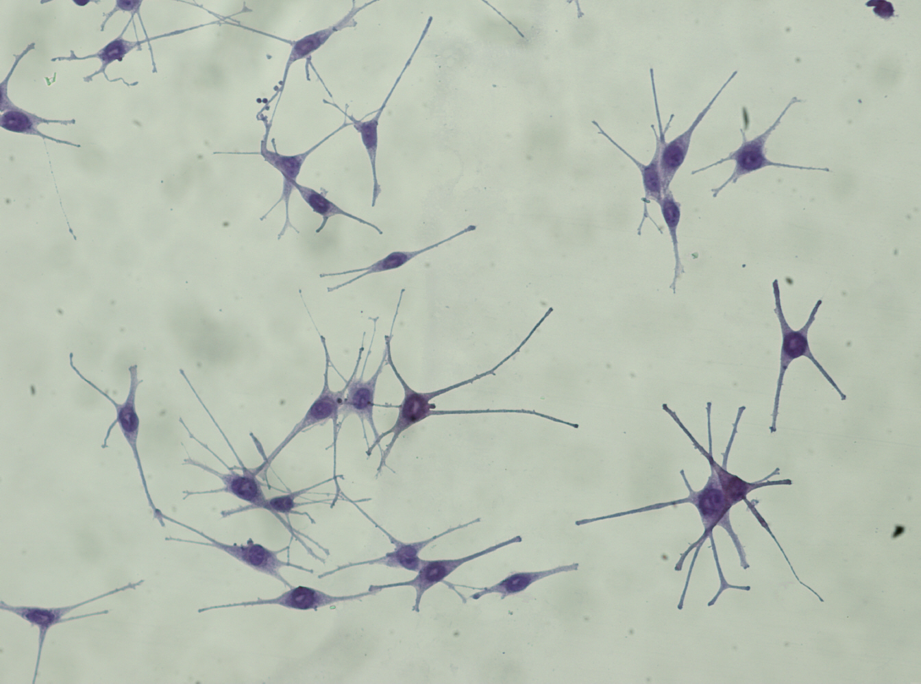 Human senescent melanocytes in vitro model | QIMA Life Sciences