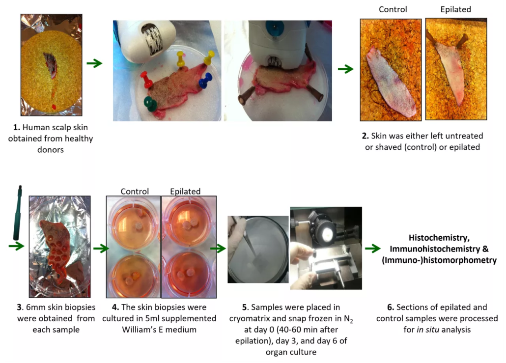 Epilation and analysis of human scalp