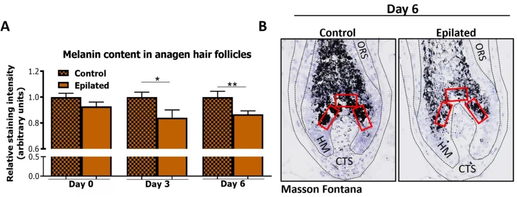 Melanin production in hair follicle after epilation observed by microscopy and quantified