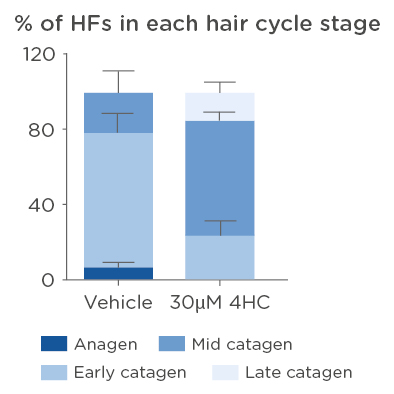 QIMA LS_CIA_Catagen development in hair follicles ex vivo