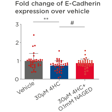 QIMA LS_CIA_Epithelial-mesenchymal transition (EMT) ex vivo