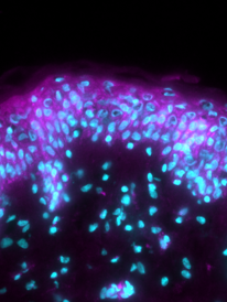 Cytrate synthase - Product + Stress