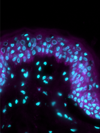 Cytrate synthase - Stress