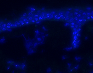 Pemphigoid disease_Complement fixation assay_negative control-PBS
