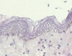 Pemphigoid disease_Crysection assay_split formation_negative control-PBS