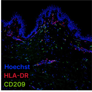 Control Human Skin - Stained for antigen presenting cells