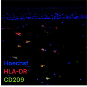 Immunocompetent FTSKi - Stained for Antigen presenting cells