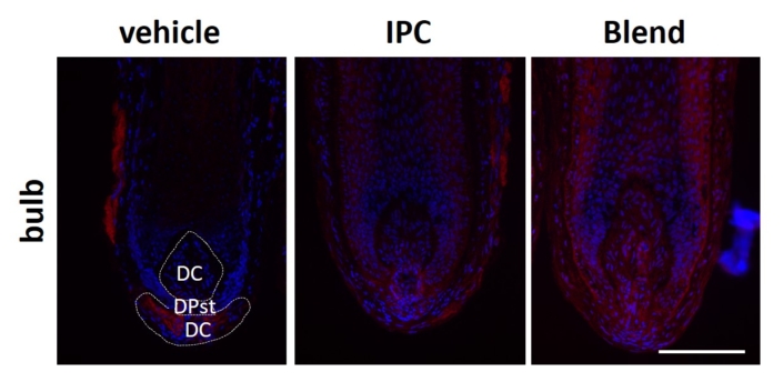 Elastin staining comparison in hair follicle bulb, vehicle vs IPC vs ingredient blend, ex vivo human hair follicle model