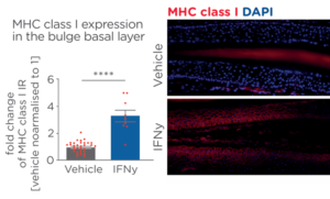 Scarring alopecia - MHC class I MHC class I expression in the bulge basal layer